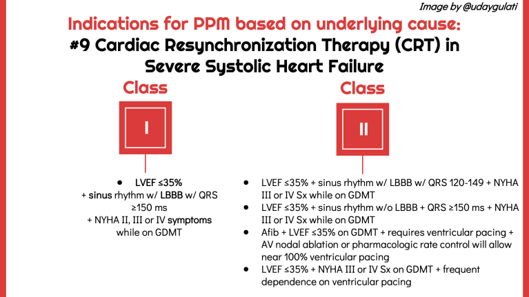 What are indications for a permanent pacemaker? – Inspired MedEd