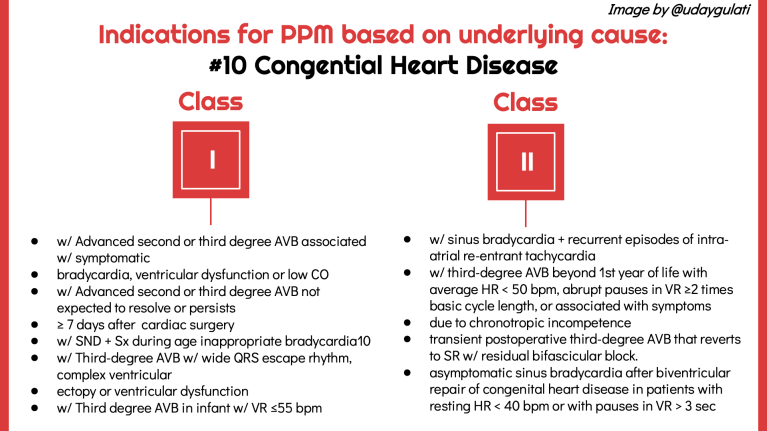 What are indications for a permanent pacemaker? – Inspired MedEd
